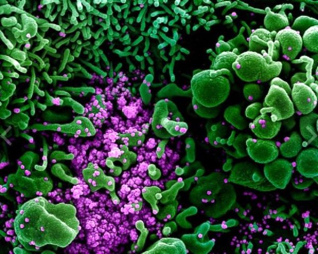 Korona virüsü insan Hücrelerine Bakın Nasıl Yayılıyor