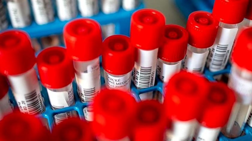 Korona Virüsün Parmak İzi Ortaya Çıkarıldı