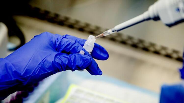 Koronavirüse karşı Türk Işın Tedavisi geliştirildi