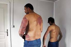 Yunanistanın Suriyeli Mültecilere Yapılan İşkenceleri