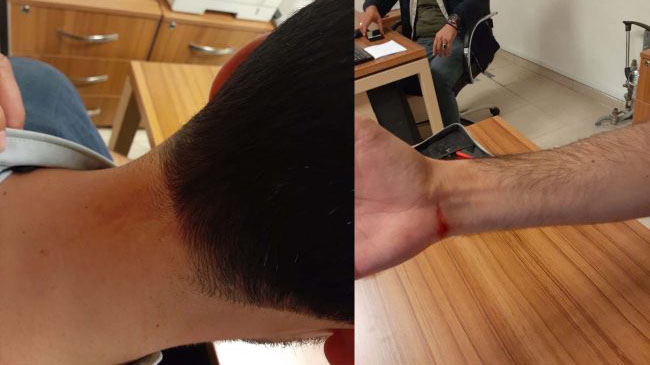 Ataşehir Belediyesi'nde işçi temsilcilerine darp