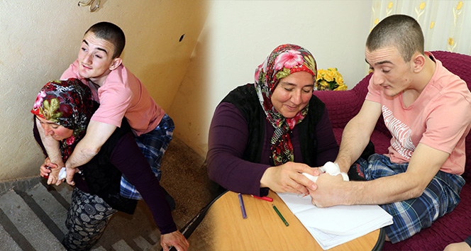 Parmaklarını yemesi engellenemiyor