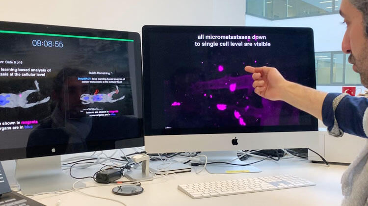 Kanser Teşhisinde Yapay Zeka Dönemi