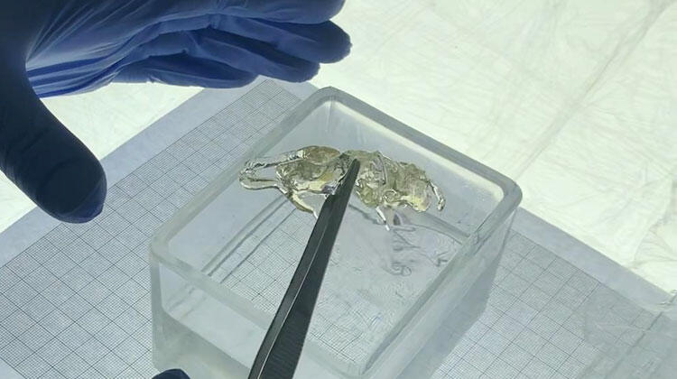 Kanser Teşhisinde Yapay Zeka Dönemi