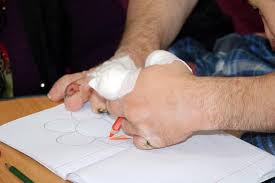 Parmaklarını yemesi engellenemiyor