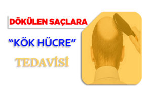 Japon araştırmacılar saç yenilenmesi için kök hücreler buldu