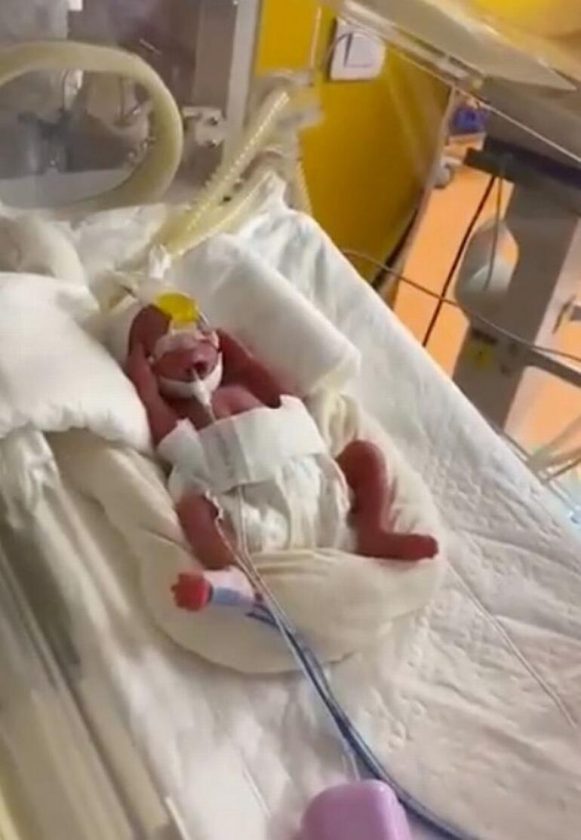 Malili Bir Kadın Dünya Rekoru Olabilecek Dokuz Bebek Doğurdu