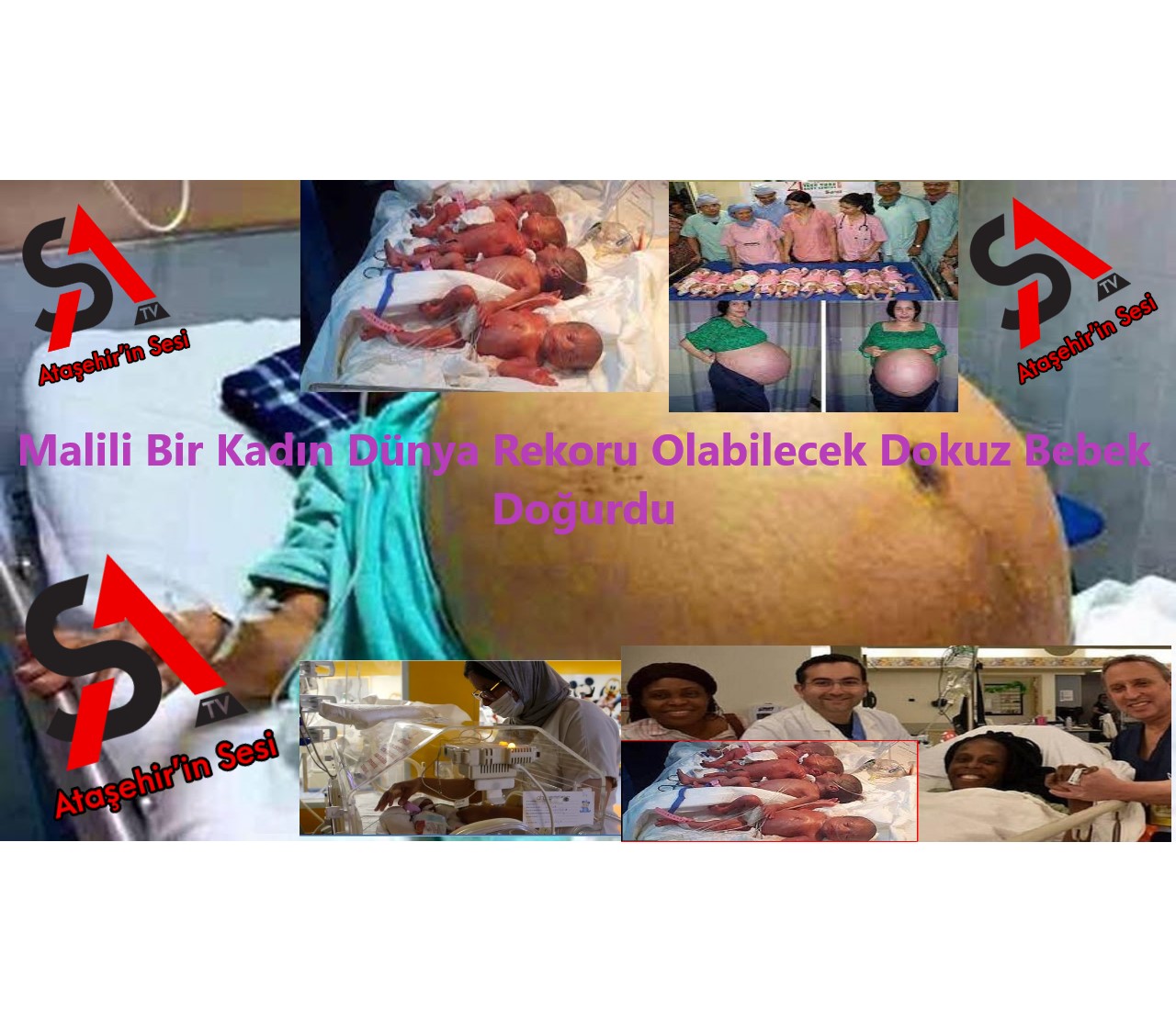 Malili Bir Kadın Dünya Rekoru Olabilecek Dokuz Bebek Doğurdu